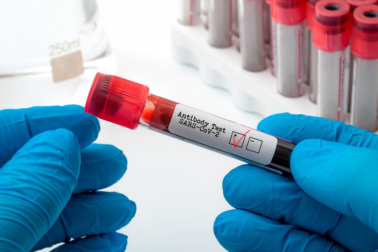 coronavirus antibodies