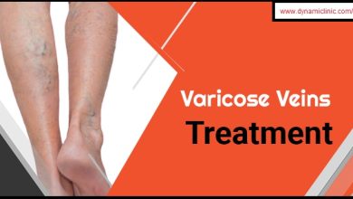 Varicose Veins Treatment in Dubai & Abu Dhabi